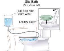 Image of Sitz bath