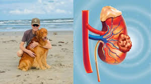 Brad Arnold Death Explained: How Advanced Kidney Cancer Becomes Untreatable