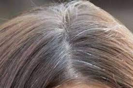Resultado de imagem para cabelos brancos