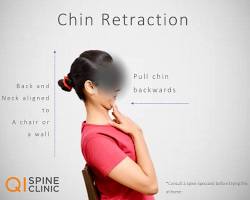 Image of Neck retractions stretch for kyphosis