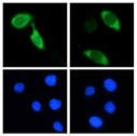 Casantibody