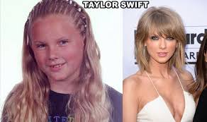 Resultado de imagem para antes e depois dos famosos