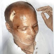 Akbar Siraj Khan was in the ICU for 10 days. The assault landed him in the Intensive Care Unit (ICU) of a hospital. Shockingly, the incident occurred barely ... - Akbar-Siraj-Khan-1