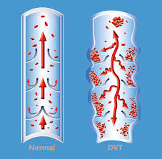 Vein Doctor in Hawaii | Diagnosing and Treating Vein Disease