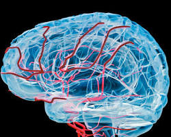 Image of Blood vessels in the human brain