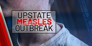 Clemson University confirms measles case at Main Campus
