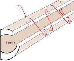 Image result for simple continuous suture pattern