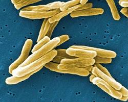 Image of Mycobacterium tuberculosis bacteria