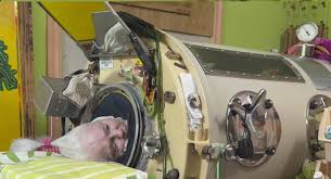 The Iron Lung's Last Breath: Martha Lillard's Legacy and the Forgotten History of Polio in Post-War America