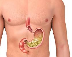 stomach with gastric acidの画像