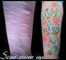 Can You Tattoo Over Scars? - Scars and Spots