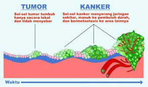 Image result for kanker