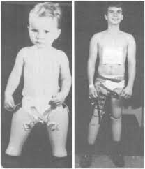 Image result for stubbies