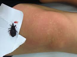 [Image: images?q=tbn:ANd9GcTOZlDSODCkW_H2G2q8Nmv...OdHjyDP-lQ]