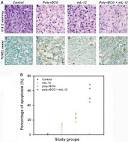 Histology, Special Stain, Immunostain, TUNEL and BrdU