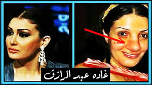 صور الفنانين قبل و بعد عملايات التجميل Images?q=tbn:ANd9GcTPk28TECf2pGaqlUjDa56JdGYoeBlLFYvvEjwH7cgzBXu67y27