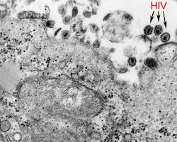 รูปภาพHuman Tcell Leukemia Virus Type 1 (HTLV1)