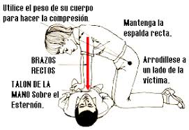 Resultado de imagen de tecnicas de parada cardiorrespiratoria