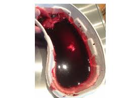 Image result for man vomits blood on the floor