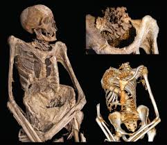 The Vác Mummy Project: Investigation of 265 Eighteenth-Century Mummified Remains from the TB Pandemic Era | SpringerLink