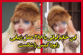 این خانم با ۳۸۸ عمل جراحی زیبایی رکورد گینس را شکست