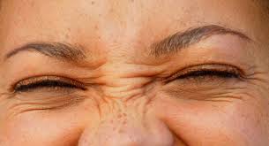 Image result for bunny lines botox