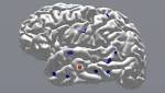  Electric pulses to brain may boost memory by 15 per cent: Study