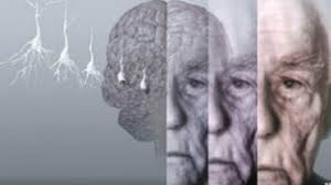 Resultado de imagem para imagens demencia