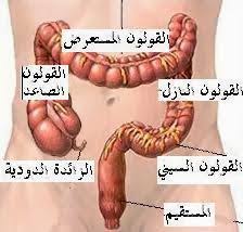 نتيجة بحث الصور عن علاج المصران بالاعشاب