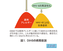 薬剤過敏のメカニズムの画像