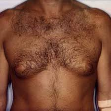 images?q=tbn:ANd9GcTa4jyRScCx2rlWX_JHUwJb66Tno5P04ybIltDkXkCJzEcGg3LJtw