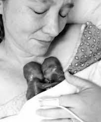 Miscarried at 19 weeks, identical twins, Jonathan and Clark ...