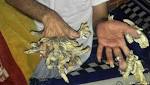 عمر يتحول إلى "شجرة" بسبب