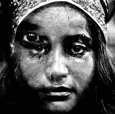 Arthur Omar “A Menina dos Olhos”. A Menina dos Olhos, 1973-1997. Joel-Peter Witkin – unable to locate title of this artwork - sc3a9rie-antropologia-da-face-gloriosa-a-menina-dos-olhos-1973-1997