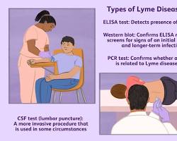 Obraz: blood sample being taken for Lyme disease testing