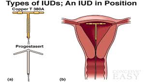 Image result for IUD image