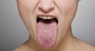 Dry Mouth: Treatment of Dry Mouth and Dry Mouth Causes Colgate