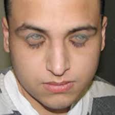 Horus Eye Tattoo On Nape - guy-with-illusion-eye-tattoos