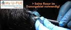 Haartransplantation fue ohne rasur