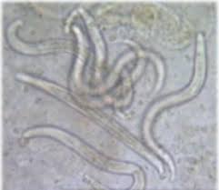 Resultado de imagen para Estrongiloides