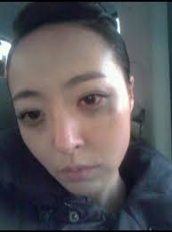 Ex-Baby V.O.X. Member Shim Eun Jin&#39;s Dark Circles Worry Fans - 493484