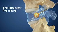 Logan pain management doctor helps eliminate low back pain with breakthrough procedure