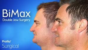 Image result for jaw surgery