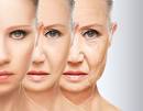 Medicina Estetica: Rughe e Photoaging, rimedi alle smagliature