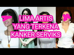 Image result for artis dan aktor terserang kanker