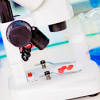 Story image for Cord Blood Transplantation With from Pharmaceutical Processing