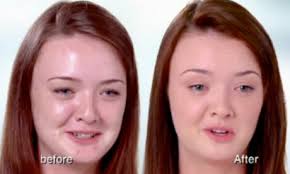 Image comment: “Before” and “after” shots from the now-banned Clean and Clear TV ad. Image credits: The Guardian - Clean-and-Clear-TV-Ad-Banned-for-Using-Makeup-2