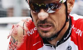 (example: Andreas Kloden). Now, Adam Myerson and others have started a Clean Athletes movement, which involves a “clean” bar of soap tattoo. - tour-de-france-injury6