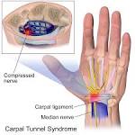 Sndrome del tnel carpiano : National Institute of Neurological