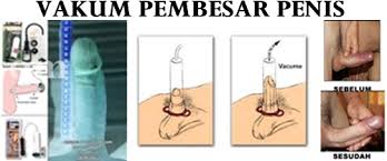 vakum pembesar penis